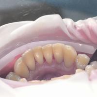 Пример работы до и после -