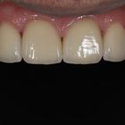 Пример работы до и после - 