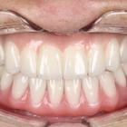 Пример работы до и после - 