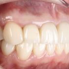 Пример работы до и после - 