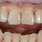 Пример работы до и после - 