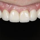 Пример работы до и после - 