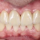 Пример работы до и после - 