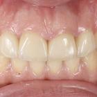 Пример работы до и после - 