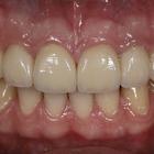 Пример работы до и после - 