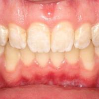 Пример работы до и после - 