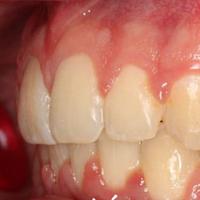 Пример работы до и после - 