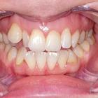 Пример работы до и после - 