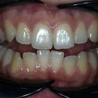 Пример работы до и после - 