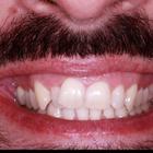 Пример работы до и после - 