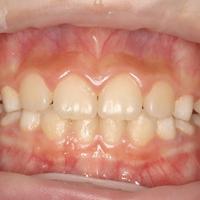 Пример работы до и после -