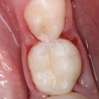 Пример работы до и после -