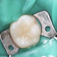 Пример работы до и после -