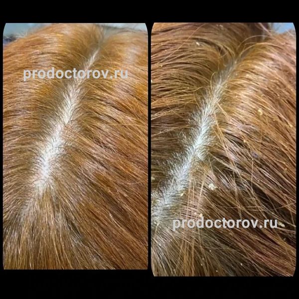 Еганян Айк Сосович, дерматолог - 78 отзывов | Электросталь - ПроДокторов