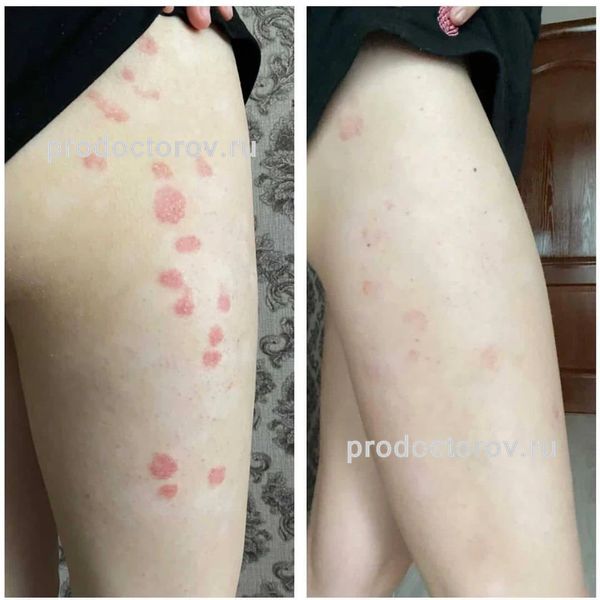 Еганян Айк Сосович, дерматолог - 78 отзывов | Электросталь - ПроДокторов