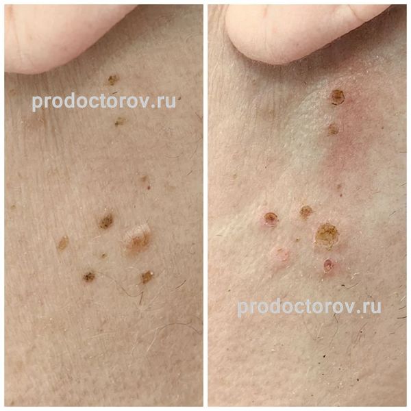 Еганян Айк Сосович, дерматолог - 78 отзывов | Электросталь - ПроДокторов