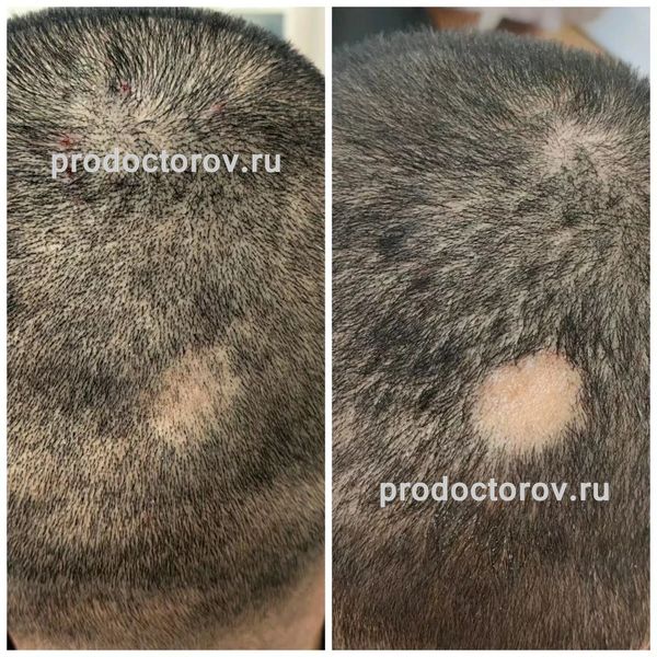 Еганян Айк Сосович, дерматолог - 78 отзывов | Электросталь - ПроДокторов