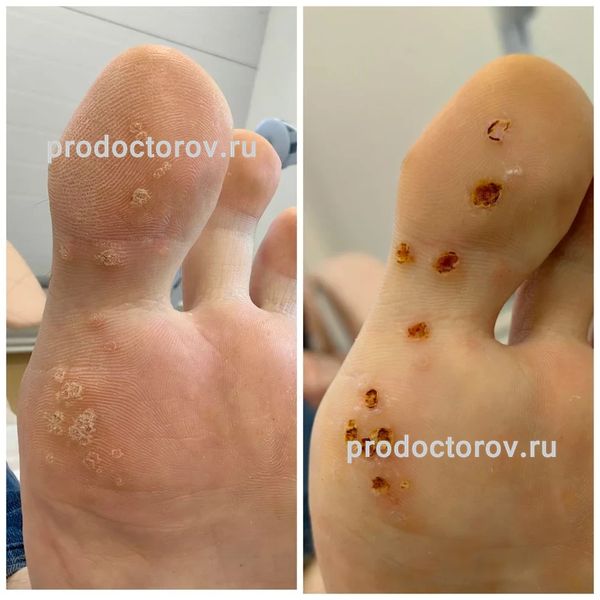 Еганян Айк Сосович, дерматолог - 78 отзывов | Электросталь - ПроДокторов