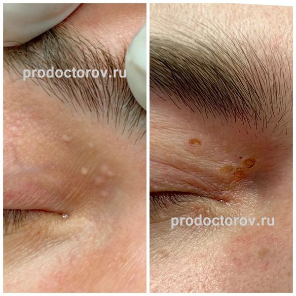 Еганян Айк Сосович, дерматолог - 78 отзывов | Электросталь - ПроДокторов