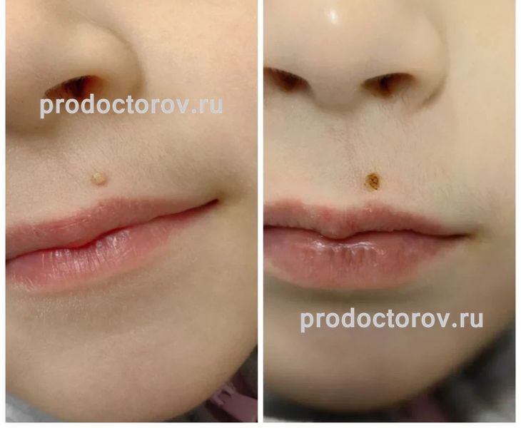 Еганян Айк Сосович, дерматолог - 78 отзывов | Электросталь - ПроДокторов