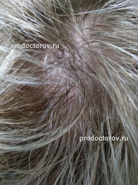 Телегина Ольга Николаевна, врач-косметолог - 17 отзывов | Иваново ...