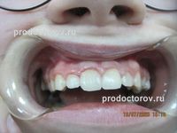 /