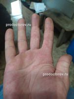 Хирургия руки в Челябинске