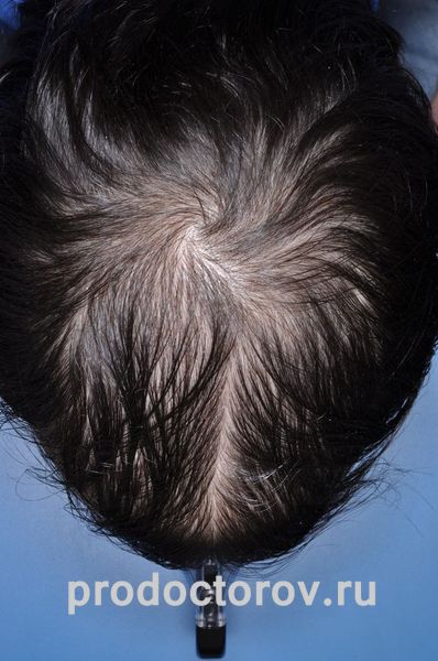 Мой пациент из СПб до лечения Сон Т. Р. - Мой пациент из СПб до лечения