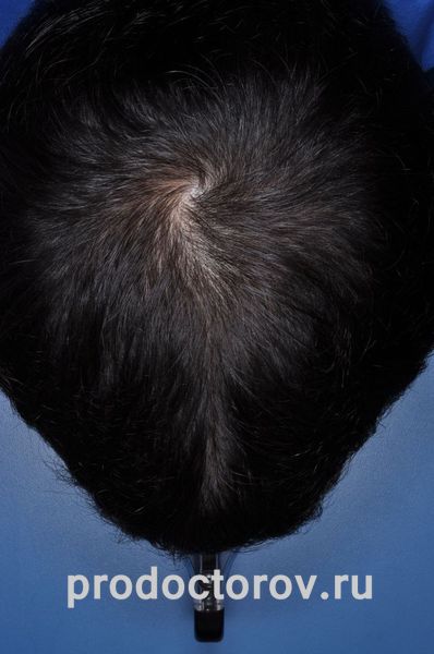 тот же мой пациент из СПб через 3 месяца лечения Сон Т. Р. - тот же мой пациент из СПб через 3 месяца лечения