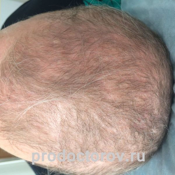 До лечения Сон Т. Р. - До лечения