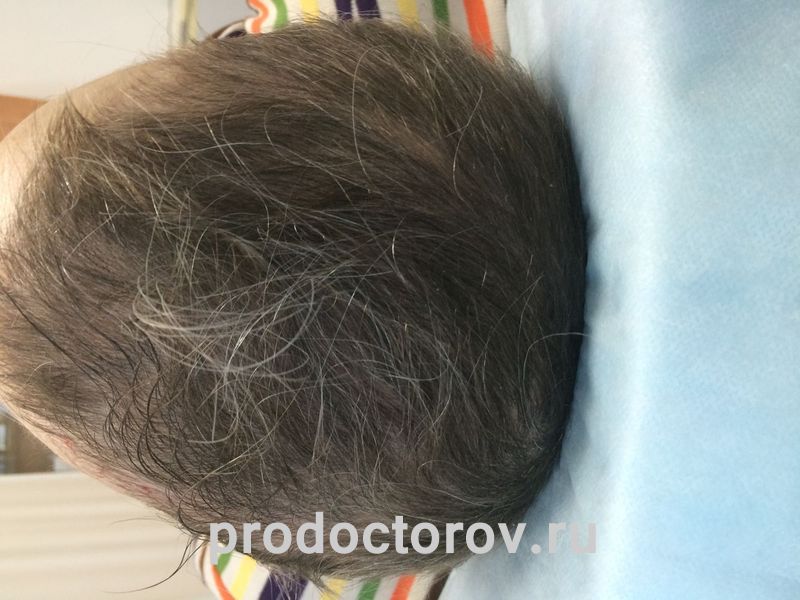 Через 3 месяца лечения Сон Т. Р. - Через 3 месяца лечения