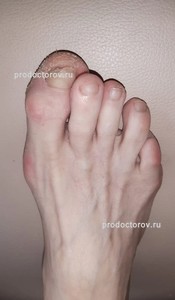 /