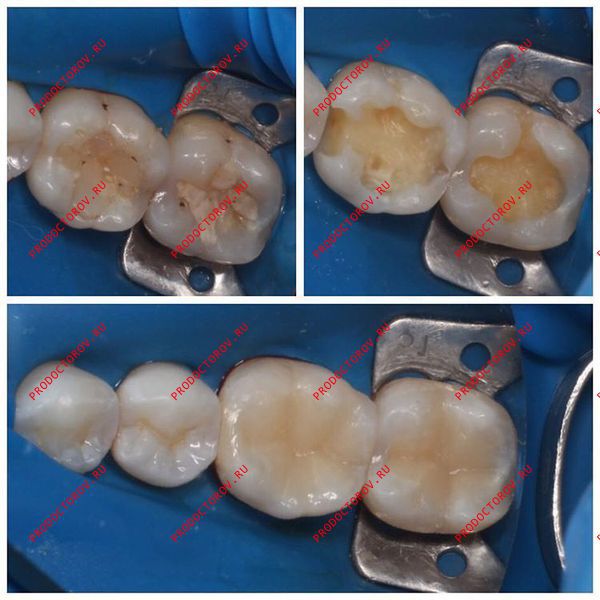 Документы и фотографии - Щербатюк М. А.