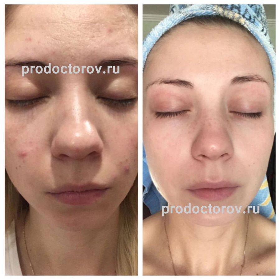 рабаданов гасаутдин габибуллаевич. султанахмедов дерматолог. халид султанахмедов. султанахмедов эдгар султанахмедович. султанахмедов эдгар энгельс.