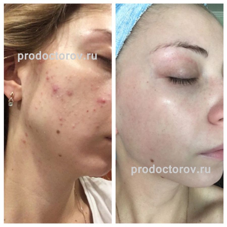 султанахмедов эдгар султанахмедович саратов. магомед султанахмедов боец. магомед базаевич султанахмедов. султанахмедов дерматолог. султанахмедов махмуд гаджибубаевич.