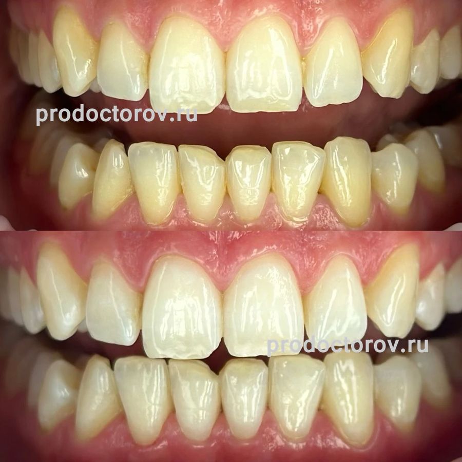 Бородина Анастасия Максимовна, стоматолог-гигиенист - 25 отзывов ...