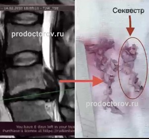 Патронажная сестра посетила на дому ребенка 2 месяцев два дня не было стула