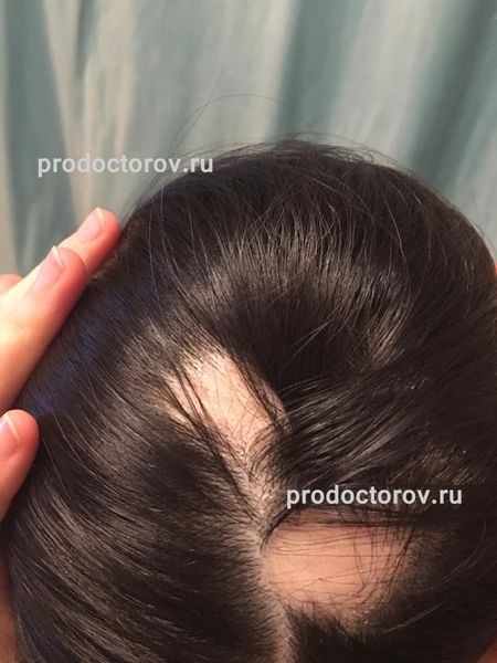 Отзывы 101 пациента о «Клинике современной трихологии» в Москве ...