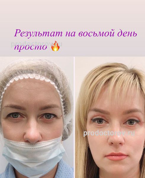 дельнова пластический хирург