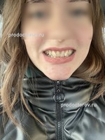 /