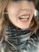 /
