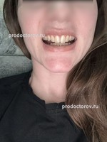 /