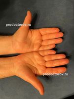 Травмы/разрывы сухожилий сгибателей и разгибателей пальцев