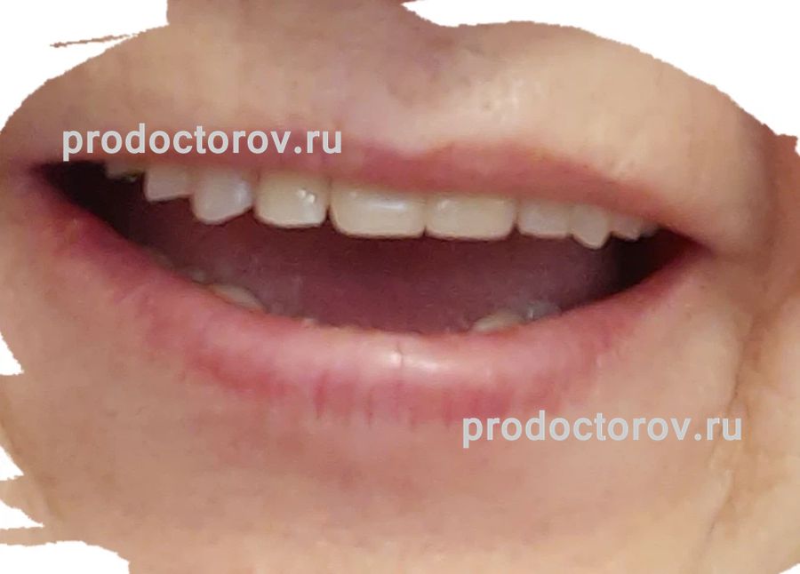 Уманская Людмила Валерьевна, стоматолог-ортопед - 17 отзывов | Рязань ...