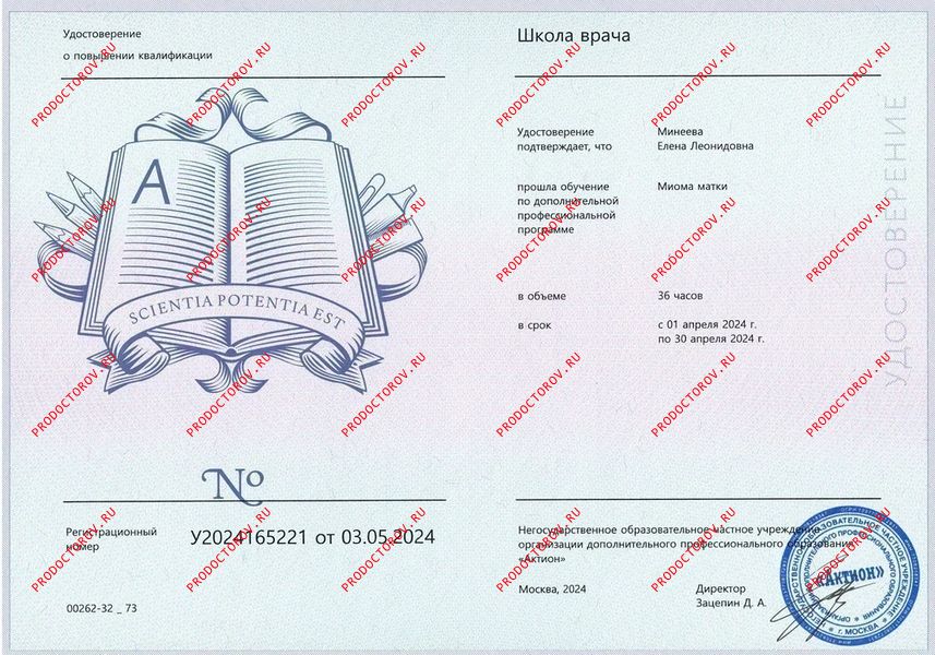 Миома матки Минеева Е. Л. - Миома матки