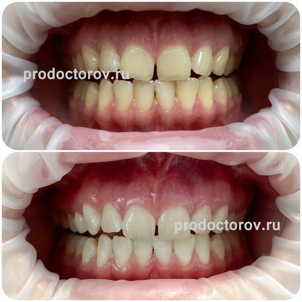 Ашихмина Ольга Викторовна, стоматолог - 59 отзывов | Сочи - ПроДокторов