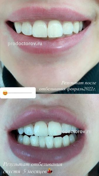 Ашихмина Ольга Викторовна, стоматолог - 59 отзывов | Сочи - ПроДокторов