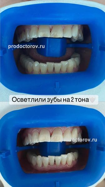 Ашихмина Ольга Викторовна, стоматолог - 59 отзывов | Сочи - ПроДокторов