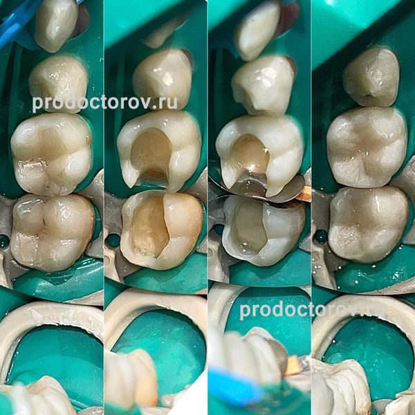 У каждого человека совершенно уникальное расположение зубов. Благодаря этому узо