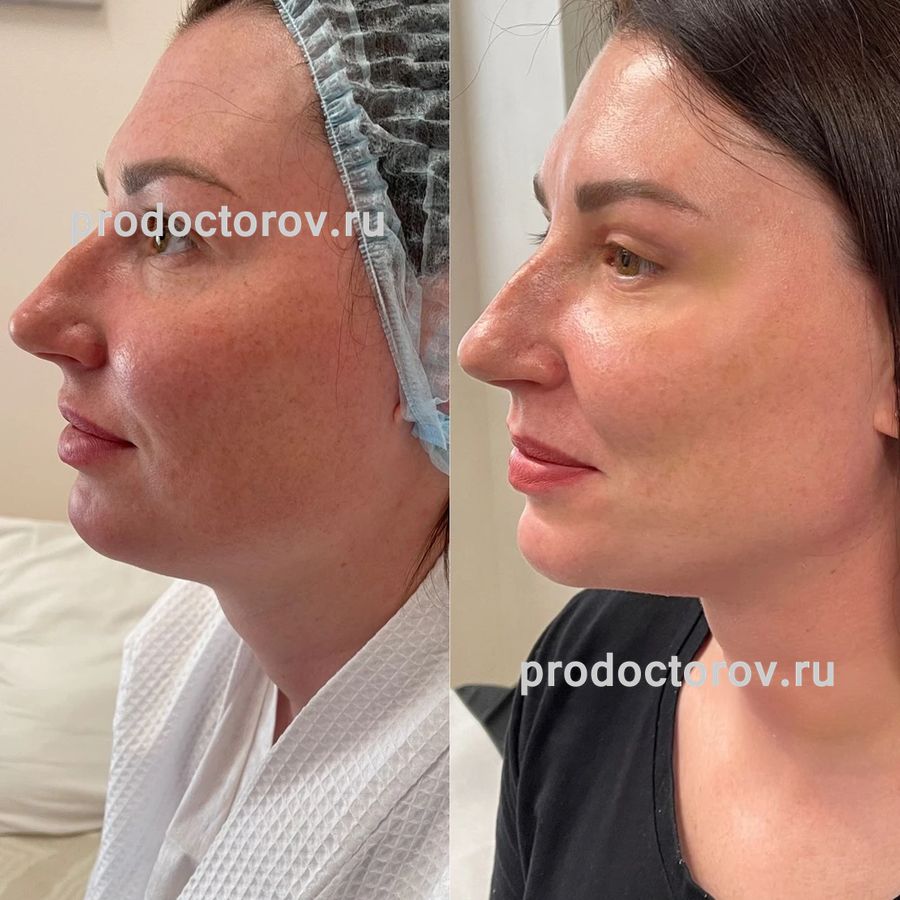 калита екатерина романовна пластический хирург. хирург ольга александровна. блохин сергей николаевич пластический хирург. калита пластический хирург. анна романовна пластический хирург госпиталь мира.